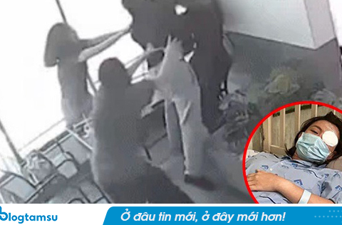 Cô gái bị người yêu cũ tác động vật lý trong quán cà phê, tổn thương 23% cơ thể: Yêu cầu bồi thường 900 triệu đồng