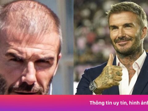 Dàn sao bóng đá ‘đụng dao kéo’ để lột xác ngoại hình