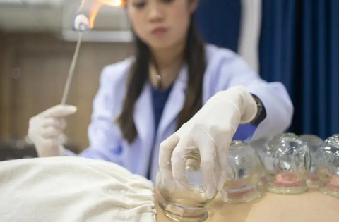 Liệt nửa người sau khi cạo gió giác hơi