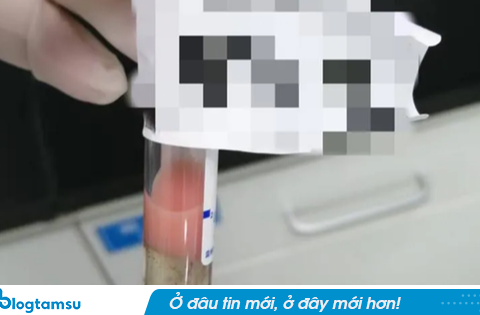 Máu biến thành “sữa dâu tây”, chàng trai 24 tuổi bị gọi gấp trở lại bệnh viện