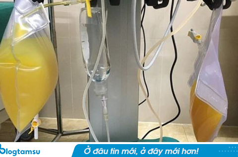 Hút ra gần 2 lít “dầu” từ trong máu người phụ nữ “thập tử nhất sinh” vì ăn thịt lợn kiểu này