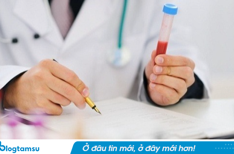 Mỡ máu tăng vọt dù không ăn dầu mỡ: Bác sĩ nói chính thói quen này là ‘thủ phạm’