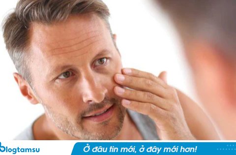 Khi UT gan “tấn công”, khuôn mặt sẽ có 3 thay đổi: Soi gương mà thấy hãy đi khám ngay!