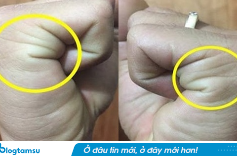 Nắm tay lại mà đếm đường chỉ tay: Ra đúng số này đời ăn không hết của