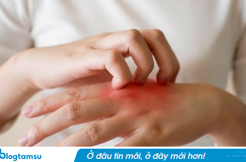 Bị ngứa vào ban đêm, đi khám mới biết chỉ còn sống được 8 tháng