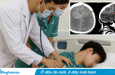 Đau đầu dai dẳng, nam sinh 19 tuổi khi đến viện mới biết bị ung thư