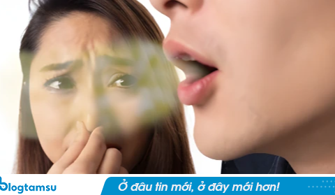 4 bất thường trong hơi thở là “điềm gở” báo UT nhưng 10 người thì 9 người đổ cho đánh răng và thực phẩm