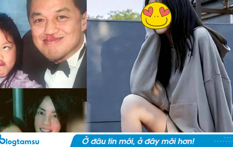 Ngoại hình con gái Vương Phi sau khi chi tiền tỷ để phẫu thuật hở hàm ếch