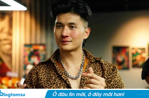 Bạn trai Lệ Quyên bị đánh đến bầm tím